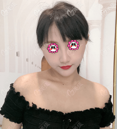 北京如朵肋软骨鼻综合