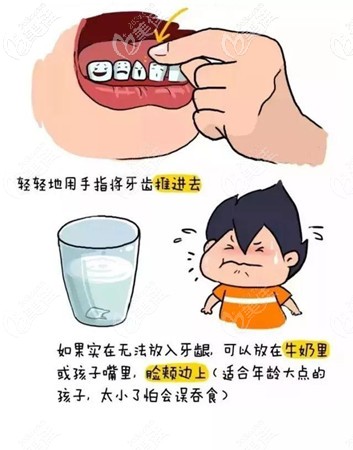 牙齿脱落后的保存办法