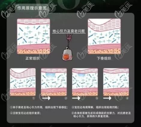 宝尼达玻尿酸作用原理图