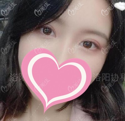 手术后恢复2个月 手术后恢复2个月