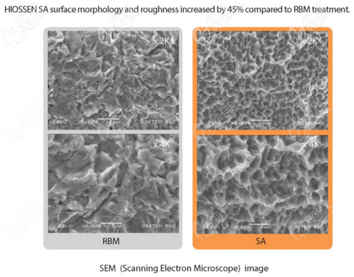 美国皓圣种植体类型