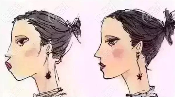 <!--<i data=20240703-sp></i>-->口腔矫正牙齿的案例 <!--<i data=20240703-sp></i>-->口腔矫正牙齿的案例