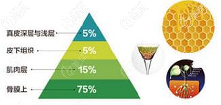 张让虎做脂肪填充面部的优势