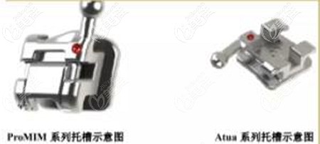 埃蒙迪自锁托槽的质量如何 埃蒙迪自锁托槽的质量如何