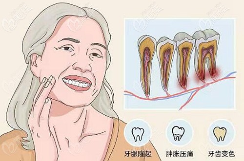 牙囊肿不治疗的后果图片