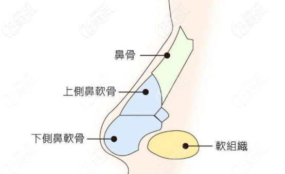 硅胶隆鼻应该剥离的腔隙的位置