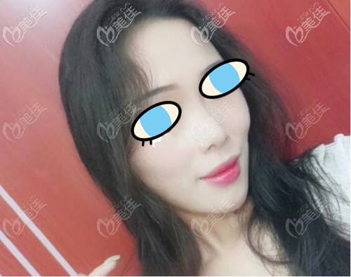 欧洲之星一个月效果 欧洲之星一个月效果