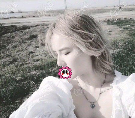 找宁波林勇做鼻子怎么样呀？想了解更多看价格和案例图