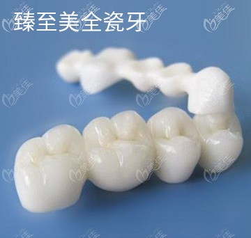 深圳麦芽口腔全瓷牙价格 深圳麦芽口腔全瓷牙价格
