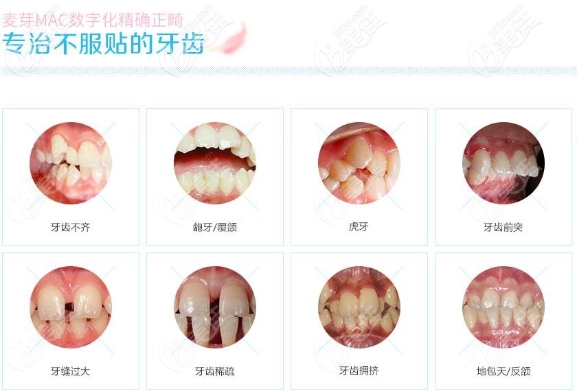 深圳麦芽口腔牙齿矫正多少钱 深圳麦芽口腔牙齿矫正多少钱