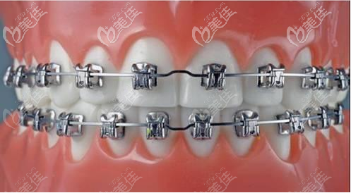 <!--<i data=20240703-sp></i>-->薇琳口腔种植牙技术正规
