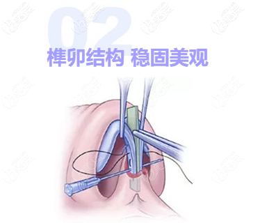 广州刘冰医生技术到底靠不靠谱