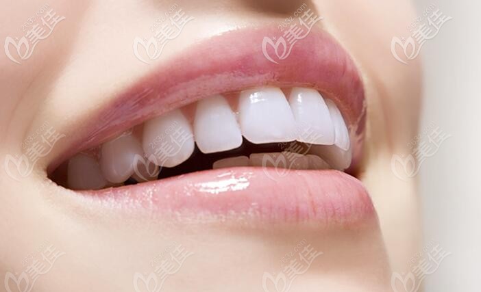 时代天使隐形矫正