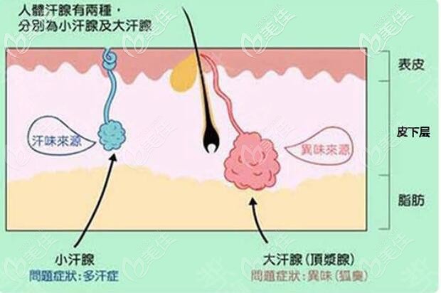 腋臭的形成原因