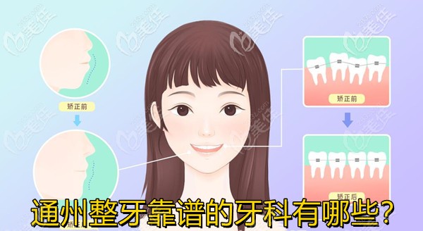 北京通州整牙靠谱的牙科