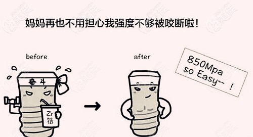 德国ICX种植体的使用寿命 德国ICX种植体的使用寿命