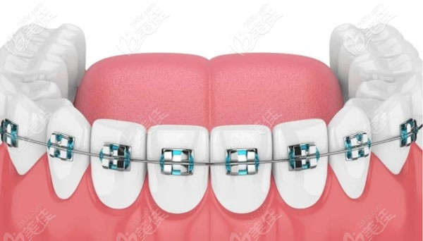 郑州南区口腔医院牙齿矫正医生 郑州南区口腔医院牙齿矫正医生