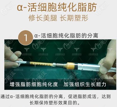 北京润美玉之光O型腿脂肪填充 北京润美玉之光O型腿脂肪填充