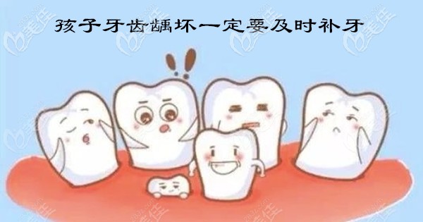 <!--<i data=20240703-sp></li>
<li><i data=20240703-sp></i>-->儿童口腔补牙多少钱一颗 <!--<i data=20240703-sp></i>--><!--<i data=20240703-sp></i>-->儿童口腔补牙多少钱一颗