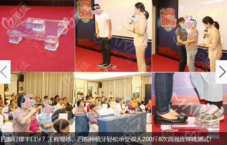 麦芽活动现场,四颗种植牙受力测试 麦芽活动现场,四颗种植牙受力测试