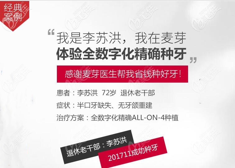 72岁老人在麦芽体验allon4下半口种植牙 72岁老人在麦芽体验allon4下半口种植牙