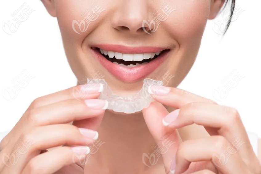 隐形牙套图示