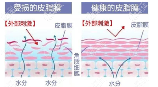 受损的皮脂膜和健康的皮脂膜之间的对比