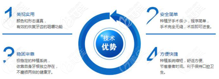 种植牙优势