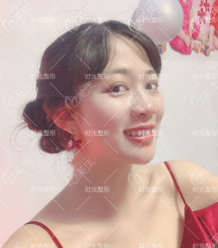 韩国医生下颌角磨骨价格不贵水平也可以，我今年10月刚做完