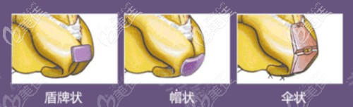 周蔚做鼻子怎么样