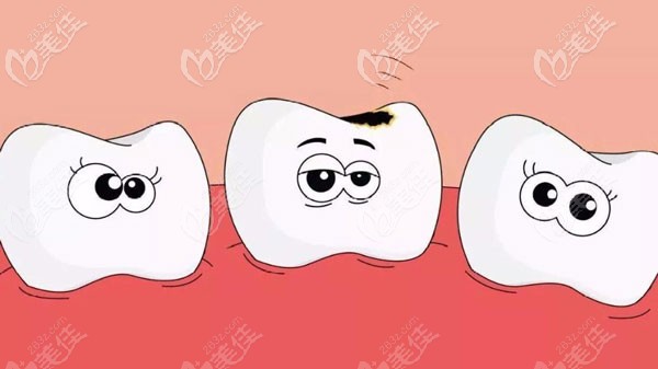 乳牙龋齿是要做根管治疗吗
