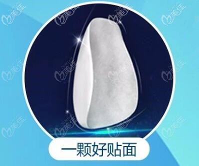 韩国水晶牙贴面