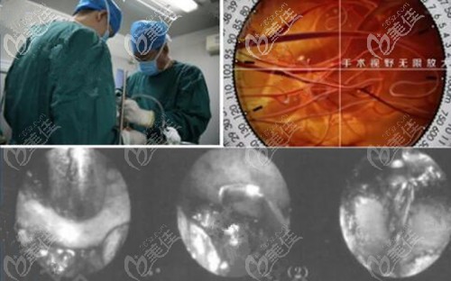 <!--<i data=20240703-sp></i>-->做颧骨怎么样