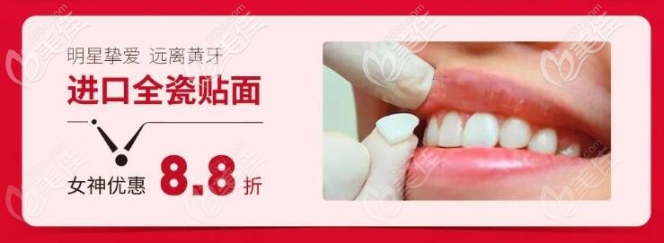 牙齿贴面活动价 牙齿贴面活动价