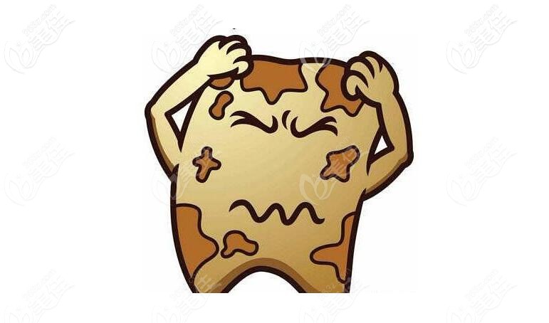 牙黄症状 牙黄症状