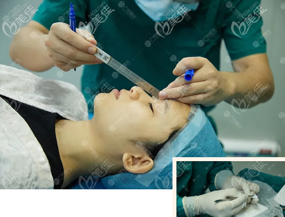 耳软骨隆鼻单侧好还是双侧好 耳软骨隆鼻单侧好还是双侧好