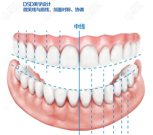 福州三栗鼠口腔的牙齿美学修复设计标准