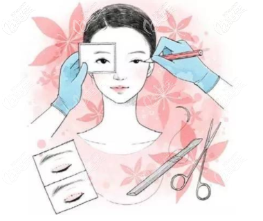 双眼皮失败评判标准