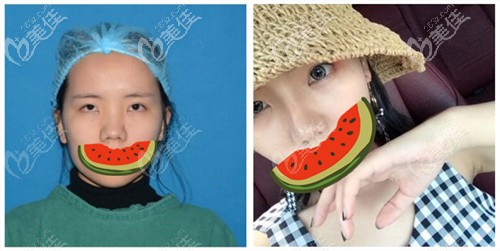 周亚超医生案例