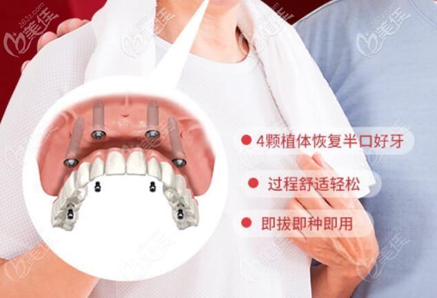 维乐半口allon4种植牙特点介绍 维乐半口allon4种植牙特点介绍