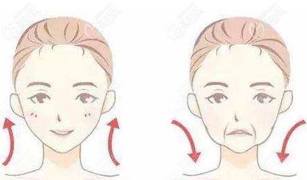 四十岁女人脸部皮肤下垂有凹陷做全脸填充好还是面部提升好