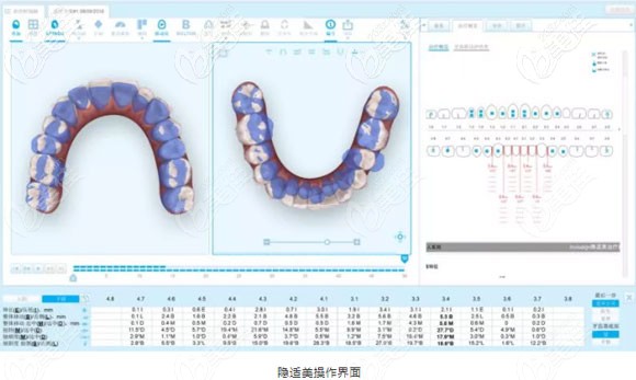 杨磊医生浅谈数字化正畸理念 杨磊医生浅谈数字化正畸理念