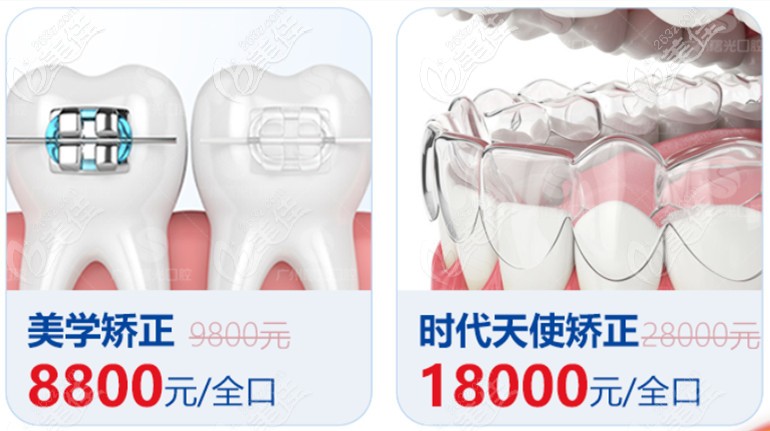 广州曙光口腔优惠活动细则