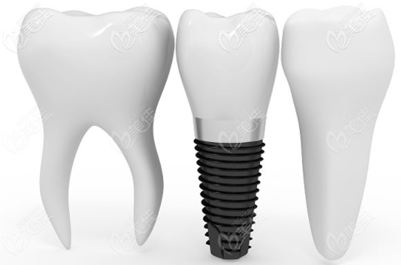 葛成院长还是诺贝尔种植品牌讲师 葛成院长还是诺贝尔种植品牌讲师