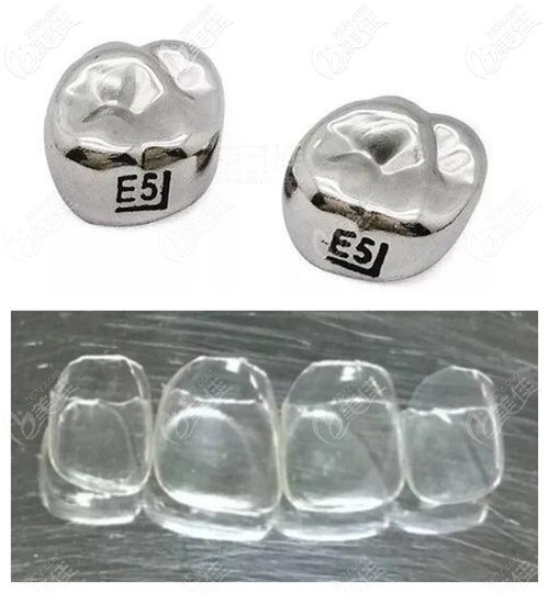 儿童戴牙冠会有副作用吗