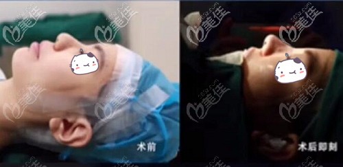 北京新星靓宫风勇隆鼻手术<span style= 北京新星靓宫风勇隆鼻手术<span style=