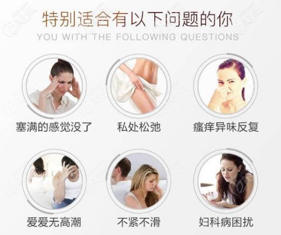 3d生物束带缩阴手术适合的人群 3d生物束带缩阴手术适合的人群