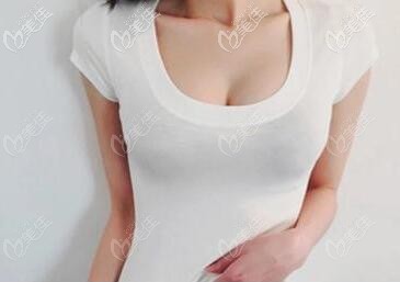 乳房悬吊术术后恢复图片