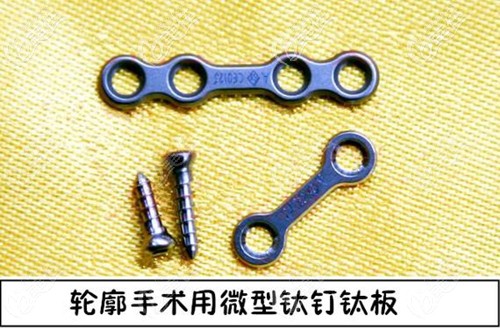 颧骨内推使用的钛钉钛板固定材料