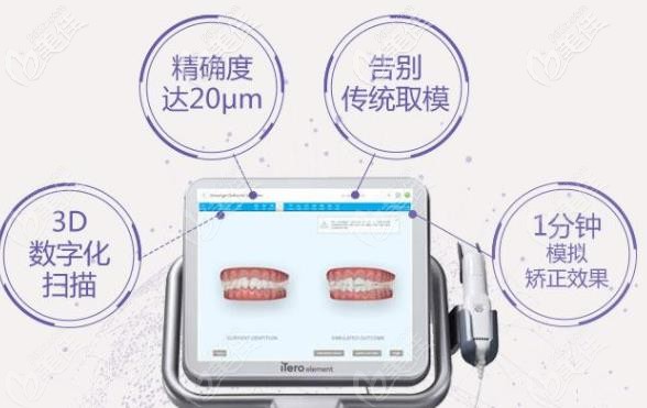 itero口扫仪的优势 itero口扫仪的优势